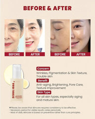 Seoul 1988 retinal serum.
